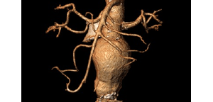DESTAQUE APRIMORAMENTO MEDICO EM DOENCAS DA AORTA
